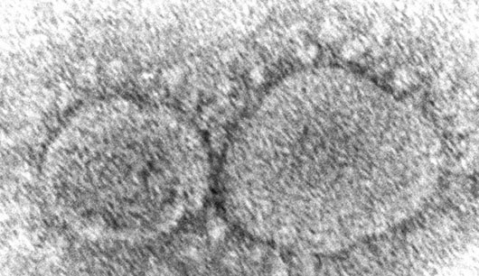 International group of virus experts call for ‘unrestricted’ probe of covid-19 origins